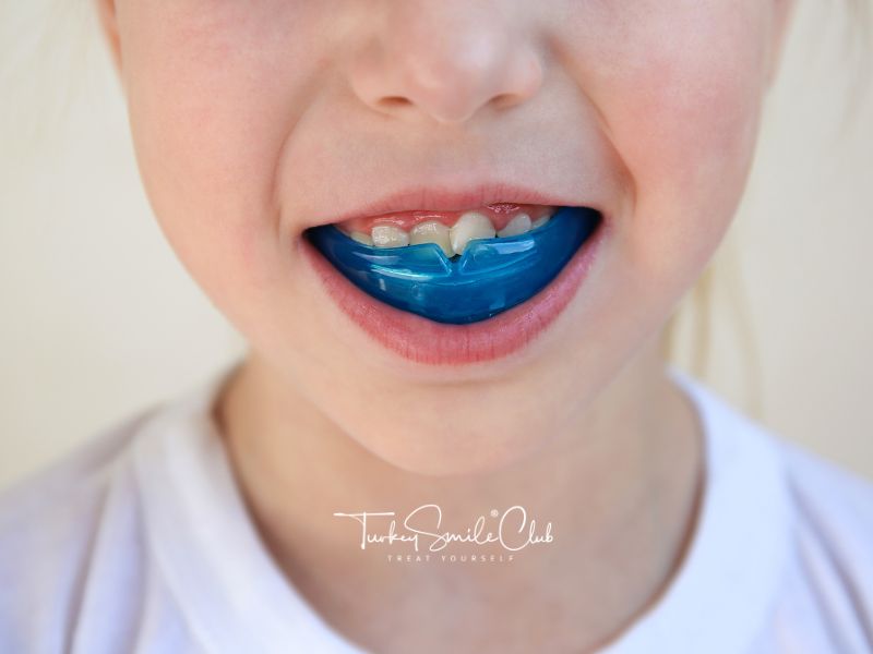buck-teeth