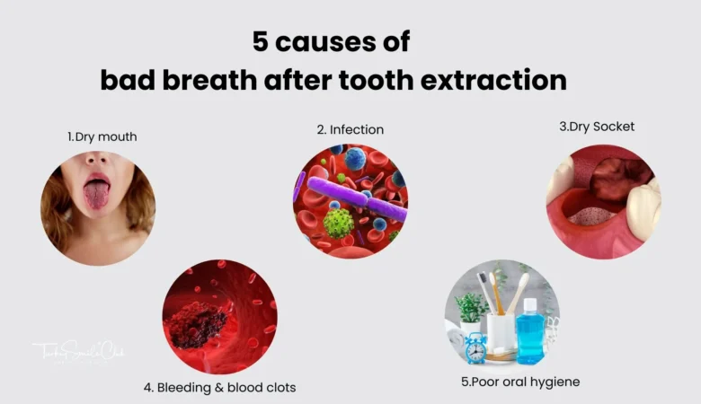 Bad breath after tooth extraction: Causes, precautions, treatment