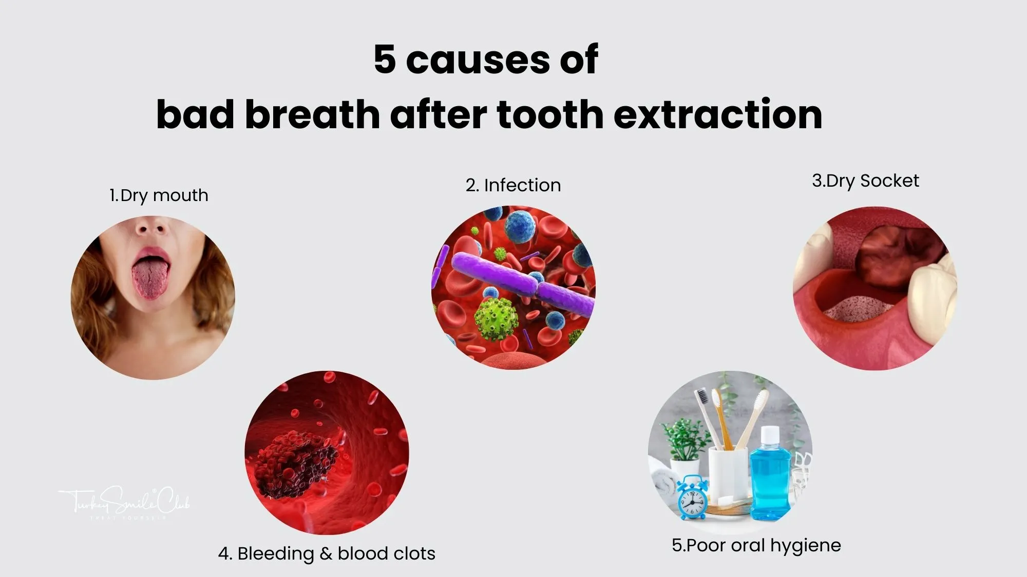 Bad breath after tooth extraction