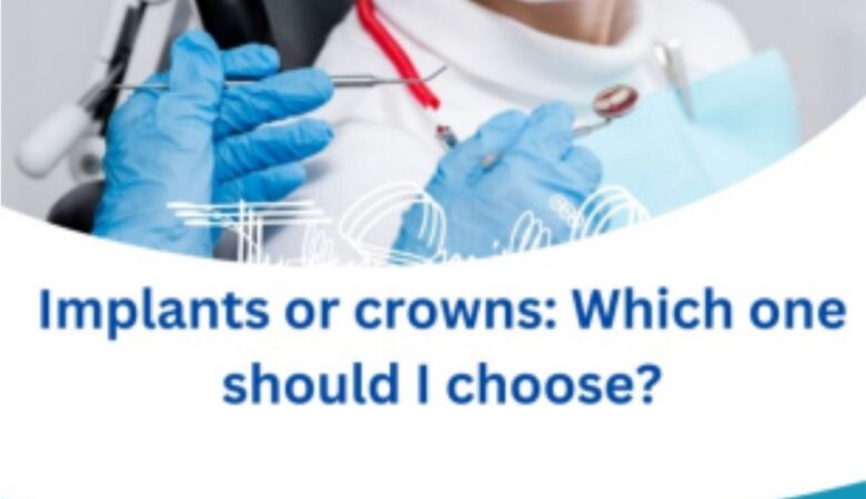 Dental implant vs crown: Pros and cons