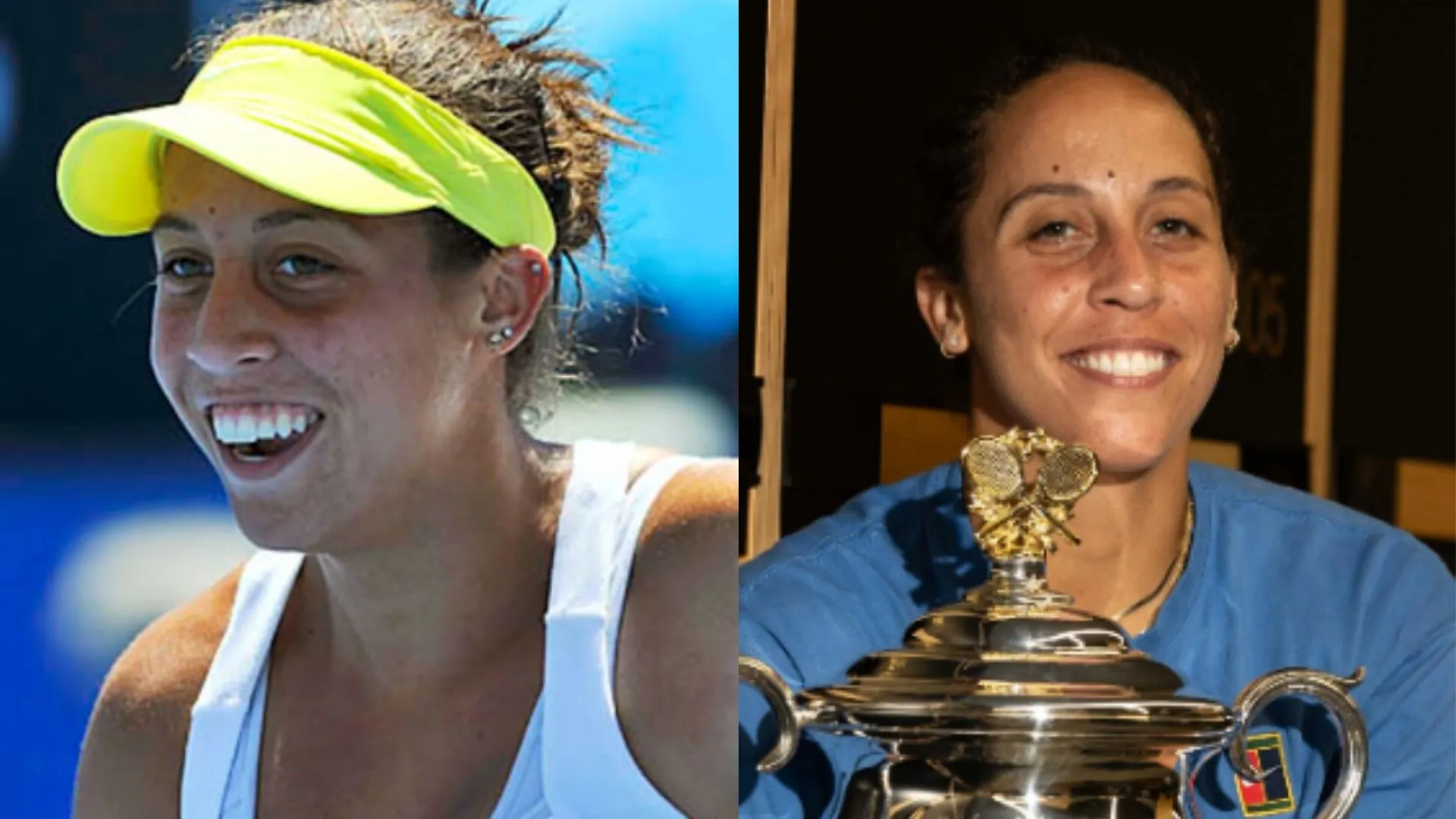 Madison Keys teeth
