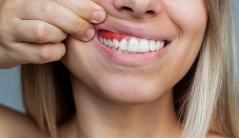 Can I get Turkey teeth with gum disease?