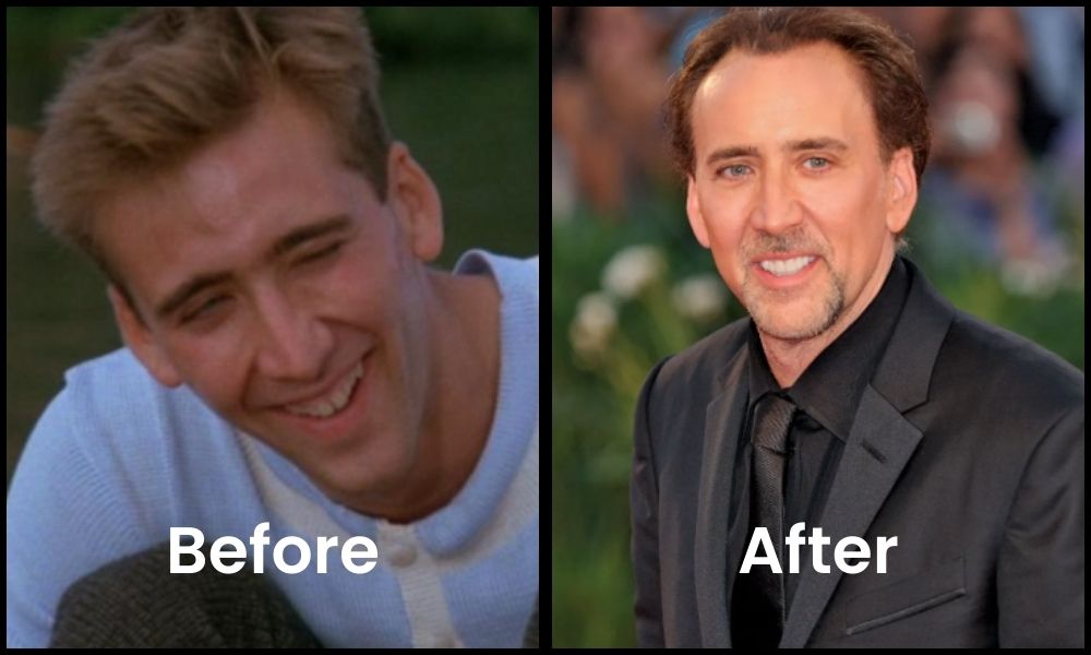 Nicolas Cage teeth