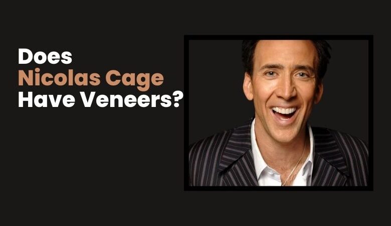 Does Nicolas Cage Have Veneers?