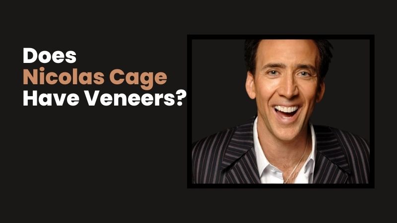 Nicolas Cage veneers