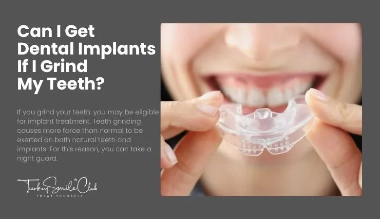 Can I Get Dental Implants If I Grind My Teeth?