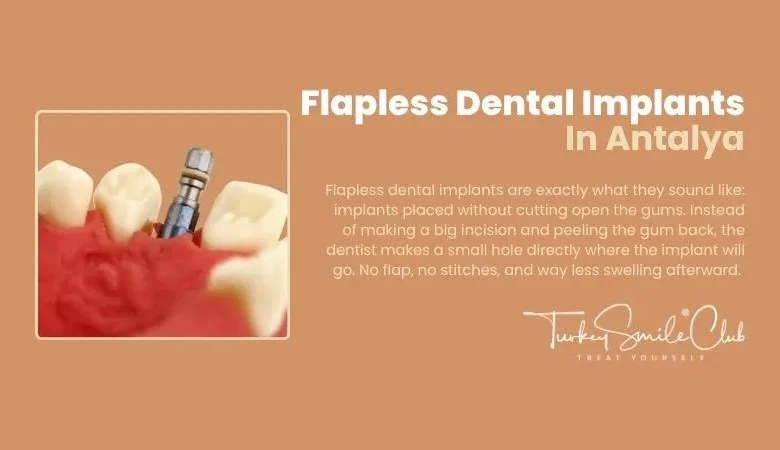 Flapless Dental Implants In Antalya