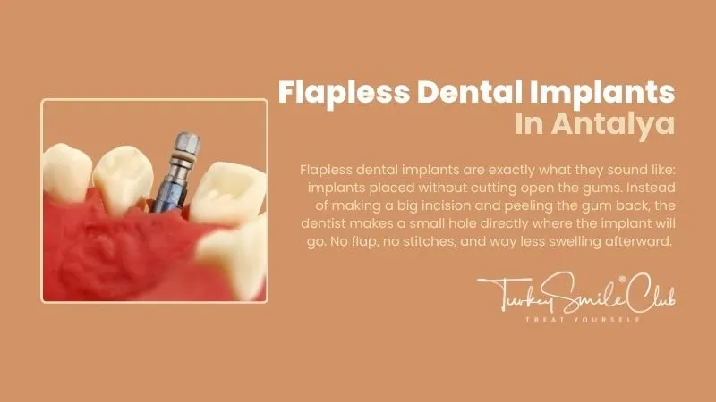 Flapless Dental Implants In Antalya
