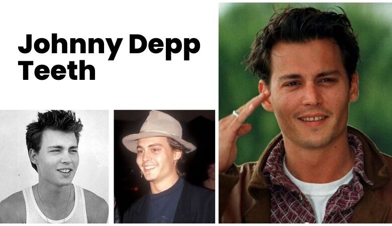 Johnny Depp’s Teeth: Before And After Photos