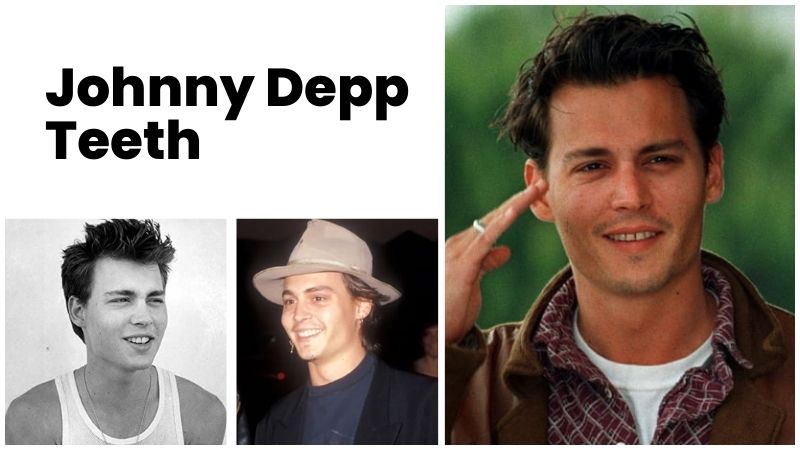 Johnny Depp Teeth