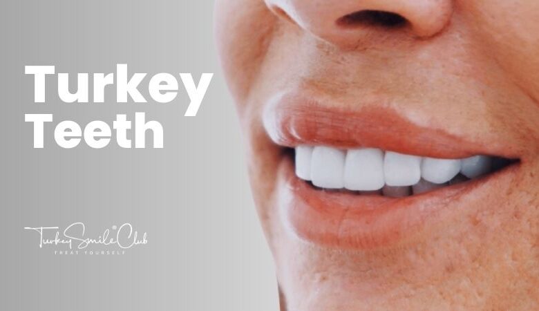 How Long Do Turkey Teeth Last?