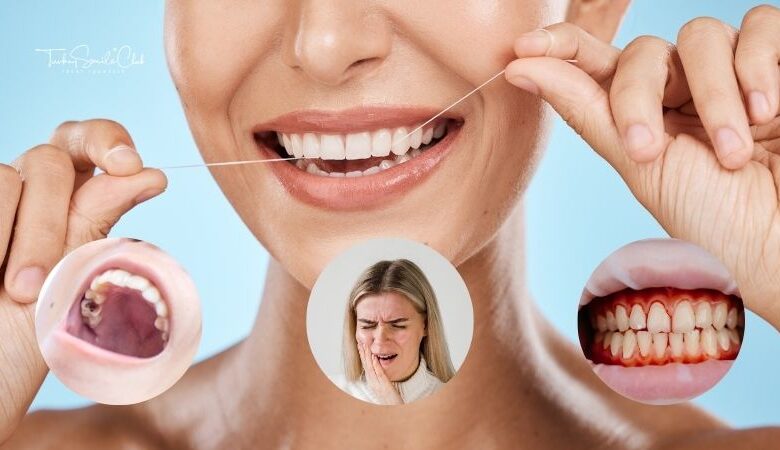 Why do my teeth hurt after flossing?