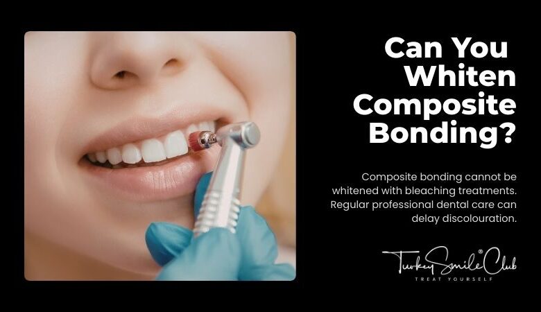Can You Whiten Composite Bonding?