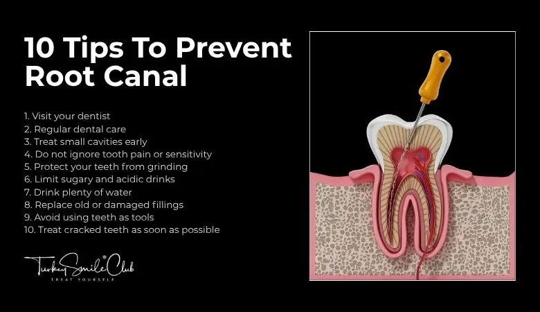 How Do I Avoid A Root Canal?