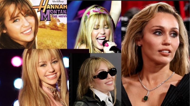 Miley Cyrus teeth over the years