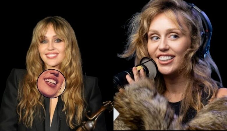 Miley Cyrus Teeth And Veneers