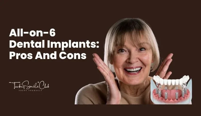 All-on-6 dental implants: Pros and cons