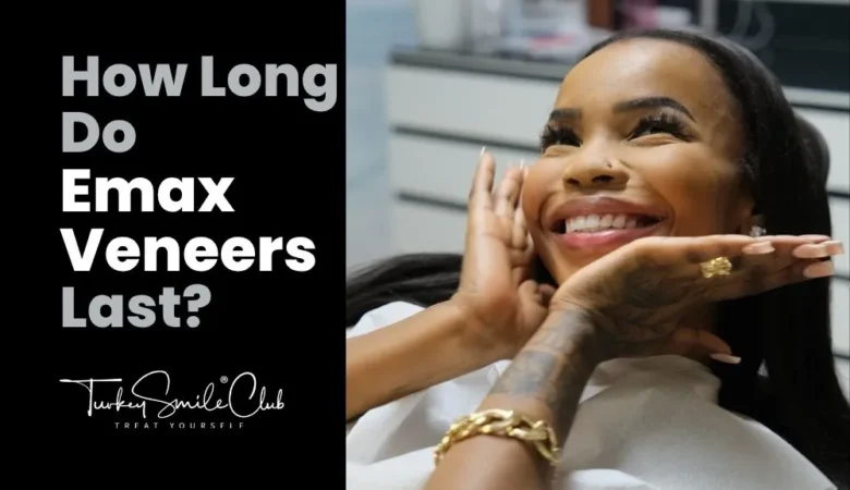  How long do emax veneers last?