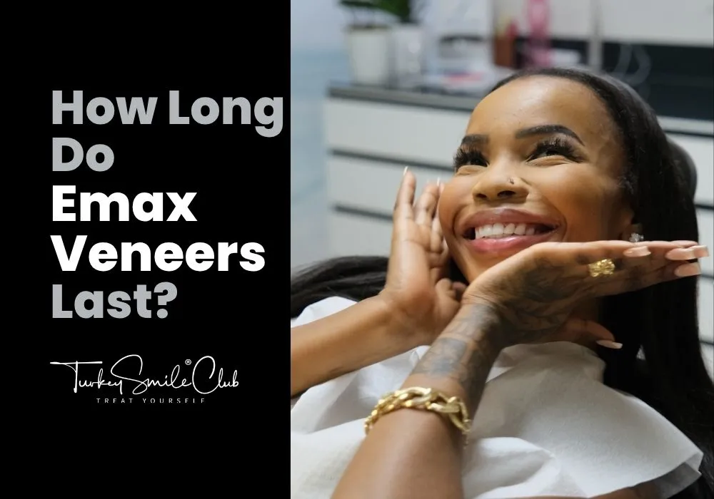 How long do emax veneers last?