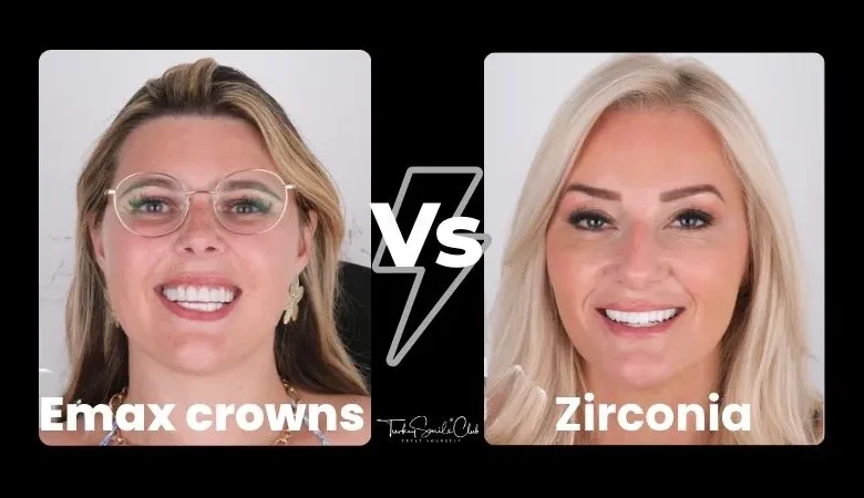 Emax crowns vs. zirconia: Which one to choose?