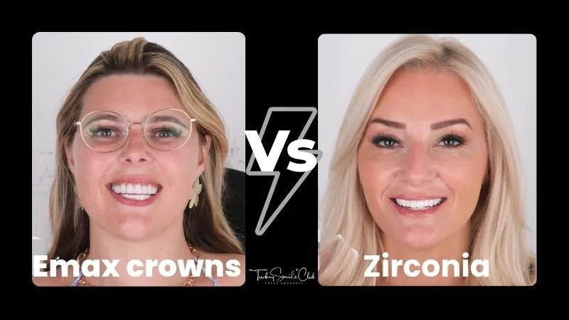 Emax crowns vs Zirconia