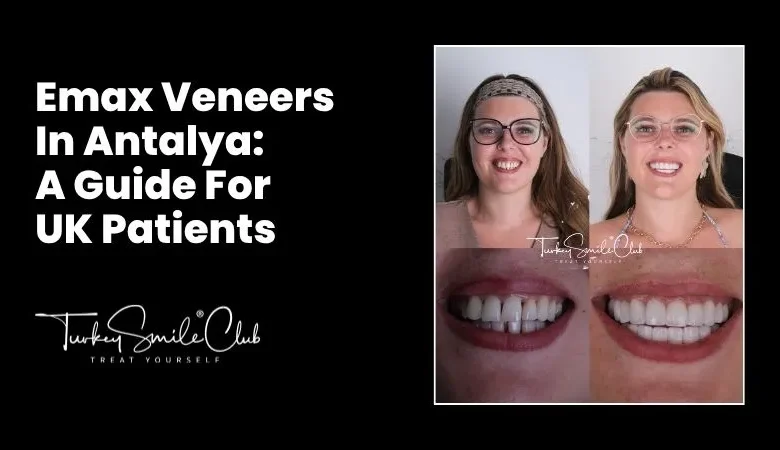 Emax veneers in Antalya: A guide for UK patients