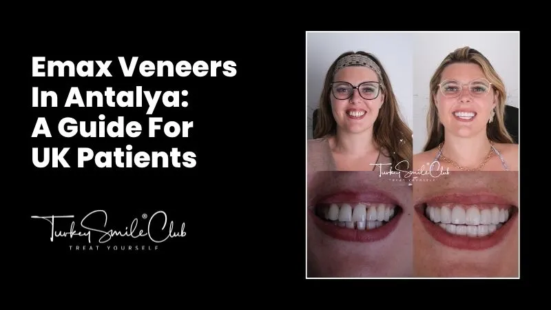 Emax Veneers In Antalya
